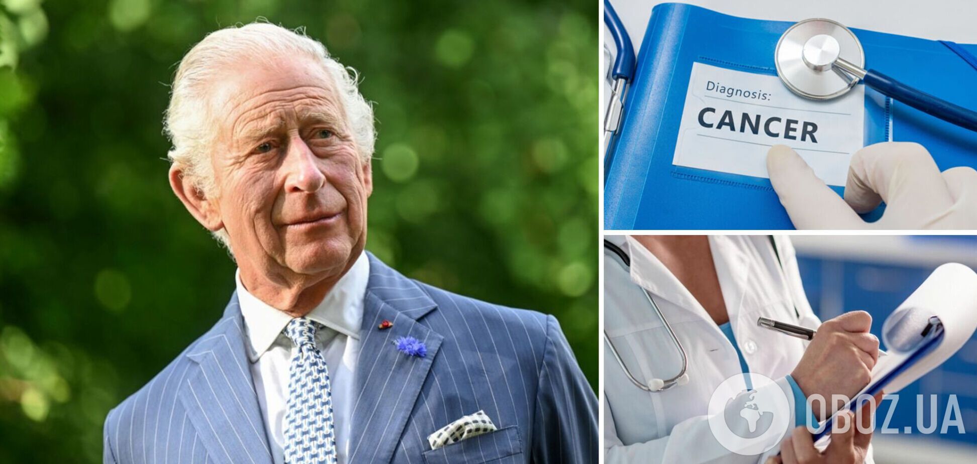 У короля Великої Британії діагностували рак – Букінгемський палац