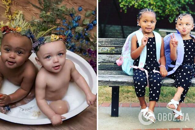Как выглядят сегодня близнецы из США, родившиеся с разным цветом кожи. Фото 7-летних Калани и Джарани