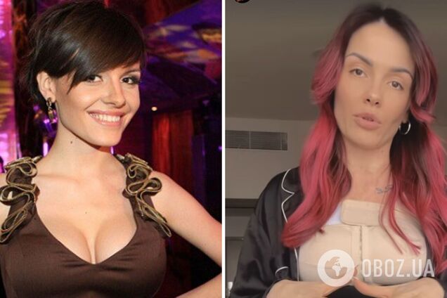 'У мене був пишний третій розмір': MamaRika зізналася, чому зважилась на маммопластику. Фото до і після