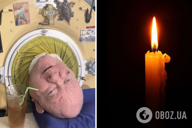 Помер чоловік, який понад 70 років прожив у 'залізній легені': хто такий Пол Александер і чому про американського юриста знали в усьому світі. Фото