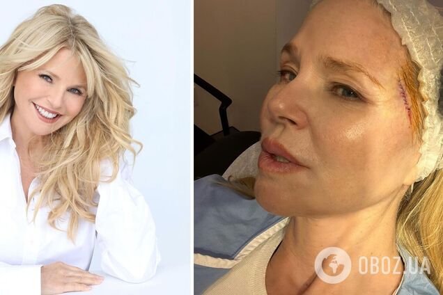 У Крісті Брінклі виявили рак шкіри: 70-річна супермодель показала перші фото після операції