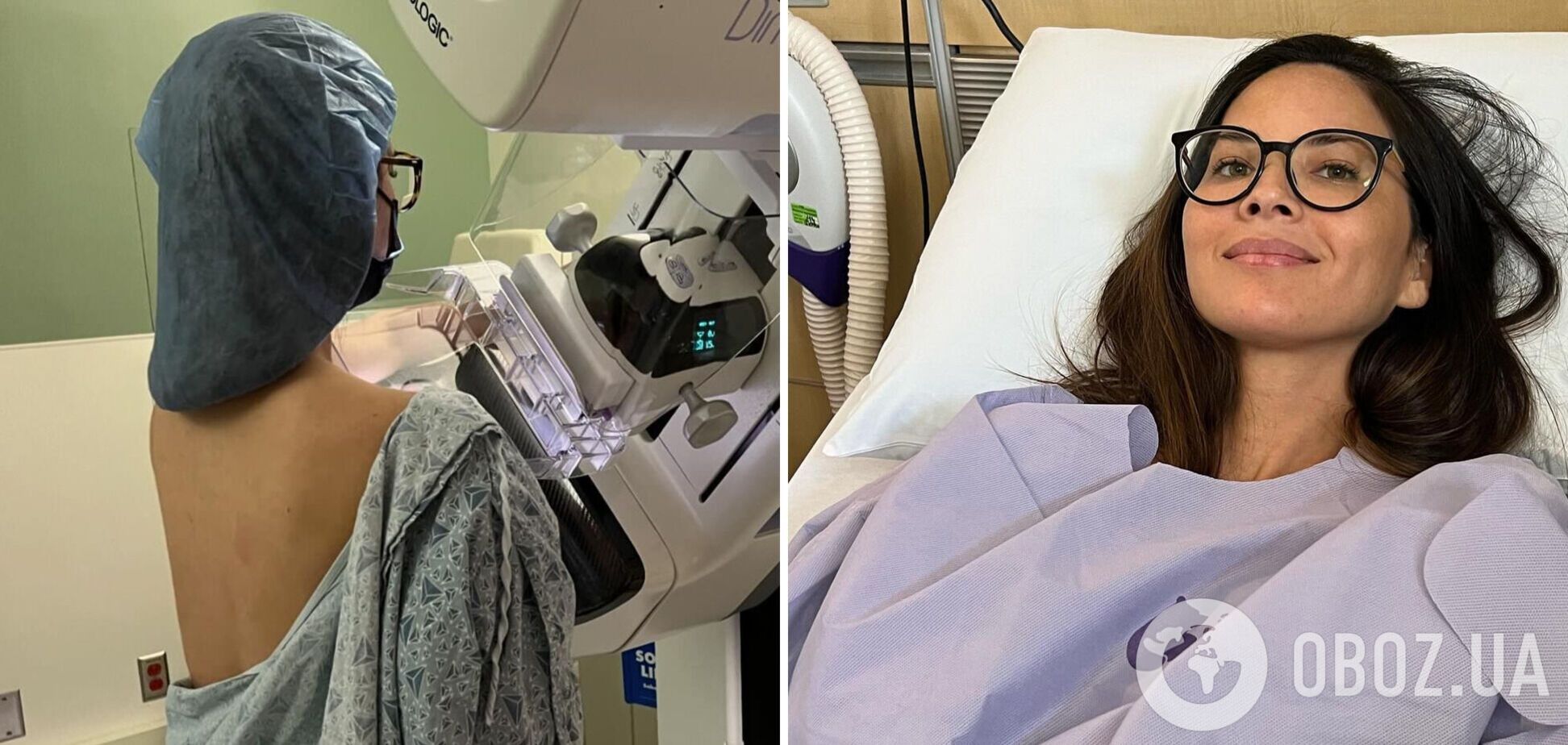 Оливия Манн сделала двойную мастэктомию: у актрисы диагностировали агрессивный рак груди