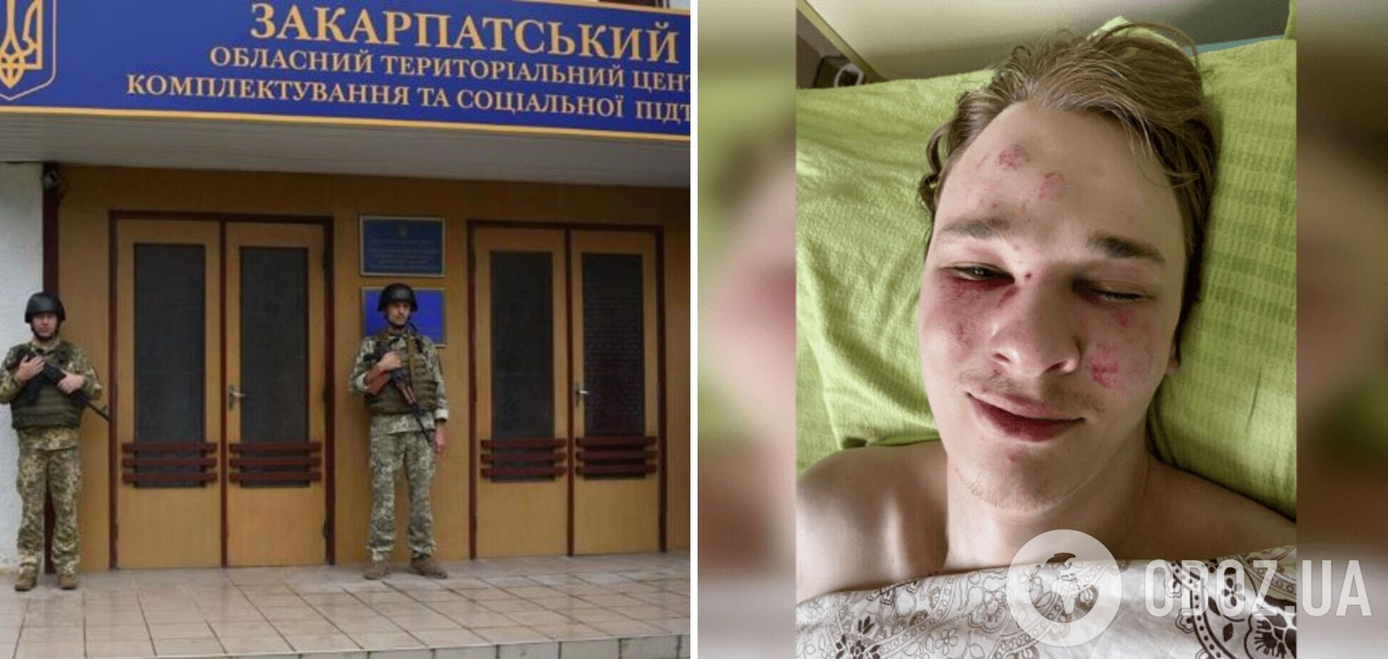 Знайшли без свідомості: у ТЦК розповіли свою версію інциденту з чоловіком, який намався покінчити з життям