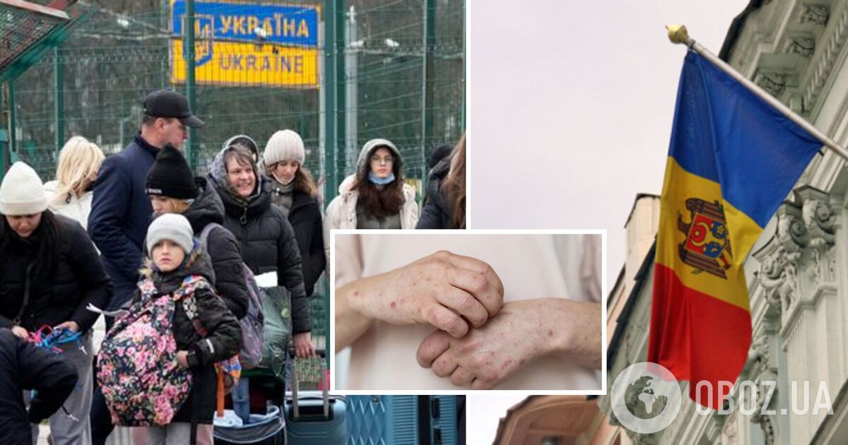 В кишиневском центре для беженцев из Украины зафиксировали вспышку кори: что происходит