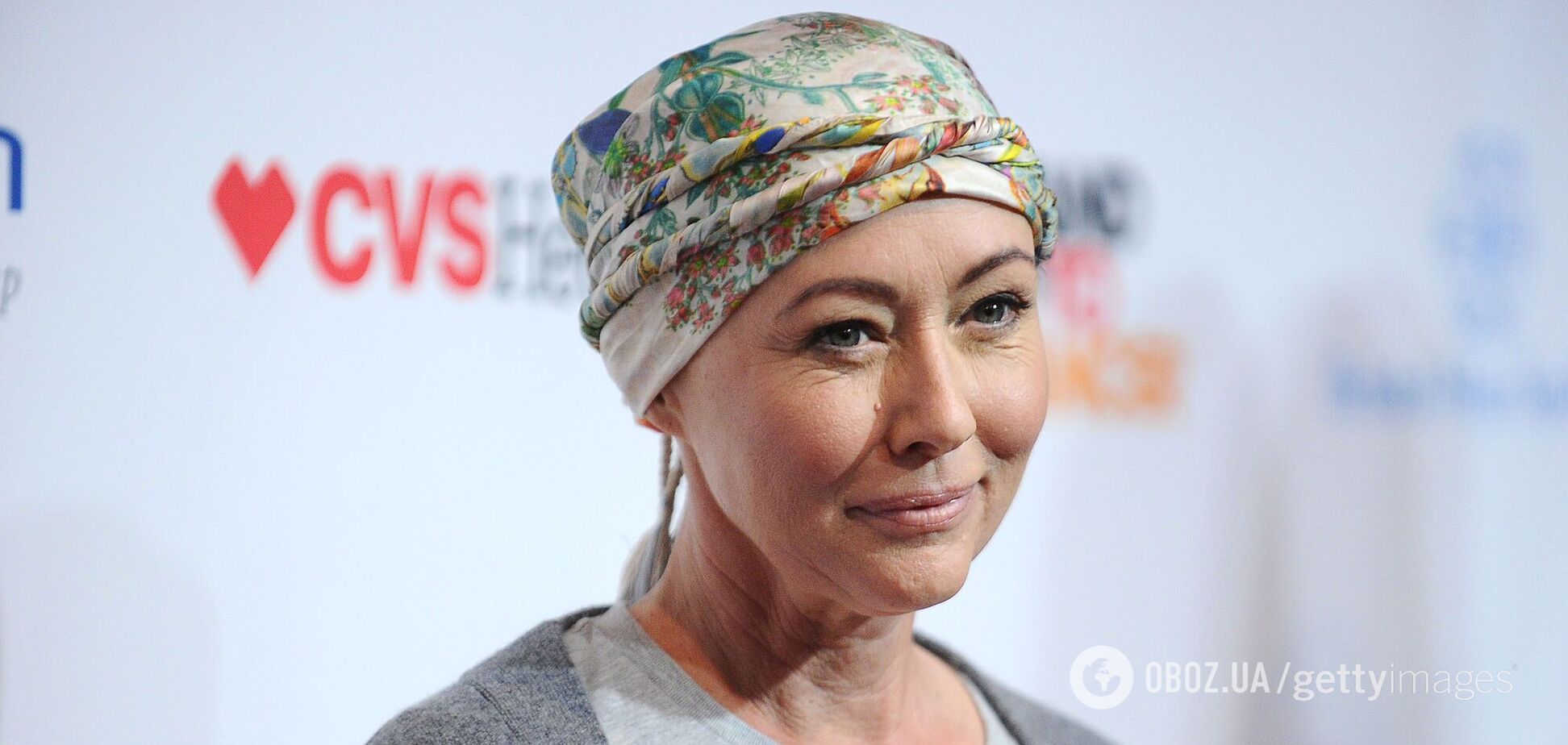 Шеннен Догерті, яка бореться з четвертою стадією раку грудей, налякала фото після видалення пухлини з головному мозку