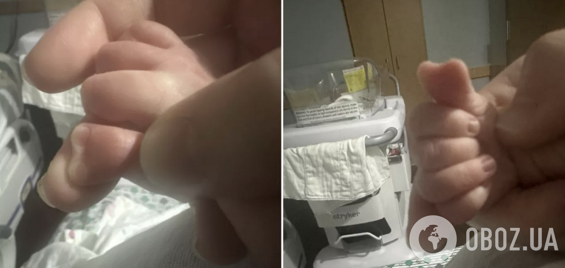 Лікарі ніколи такого не бачили: у США народився хлопчик з великим пальцем у формі серця. Фото