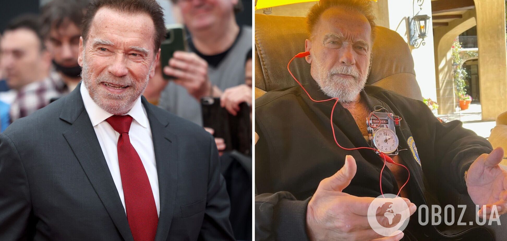 Арнольд Шварценеггер показал первое фото с кардиостимулятором