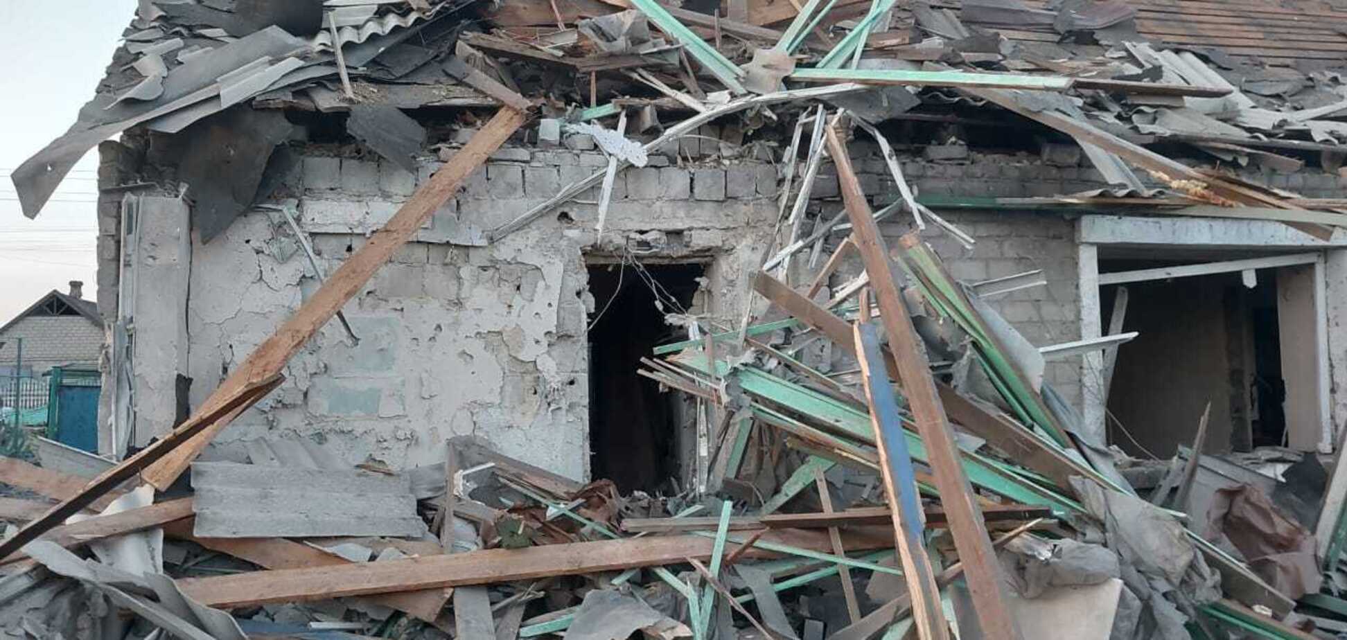 Оккупанты обстреляли жилые кварталы Донбасса: среди раненых - 16-летний юноша. Фото