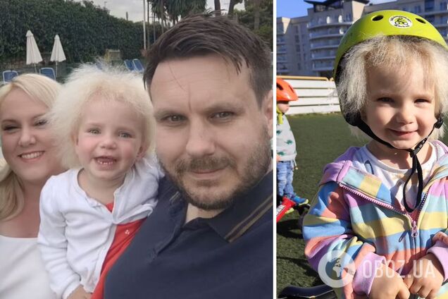 У трирічної дівчинки з Великої Британії діагностували синдром нерозчесаного волосся: таких людей лише 100 на весь світ. Фото