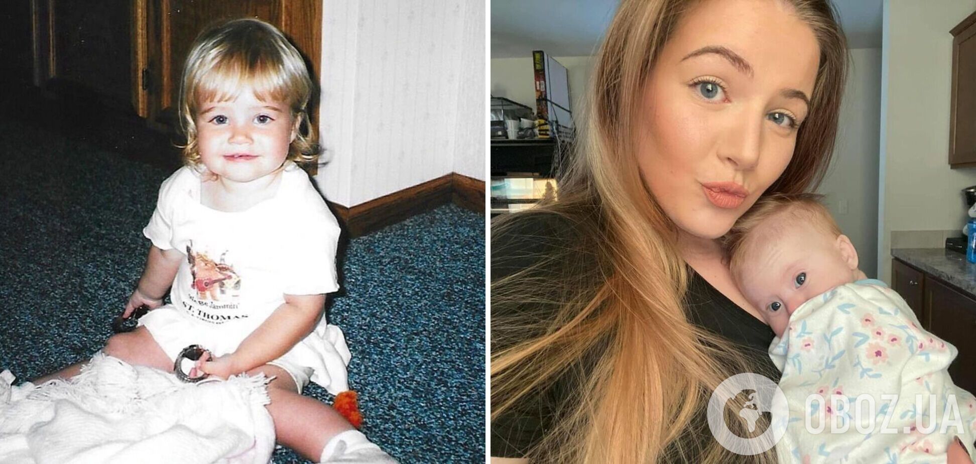 Американка узнала, что у нее синдром Дауна, только в 23 года. Как выглядит девушка и что указывало на патологию