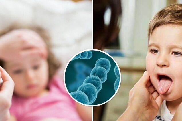 Скарлатина що це за хвороба – спалах скарлатини в Одеській області ...