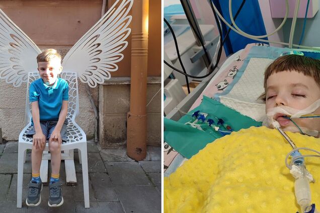 'Не имели сертификата для лечения детей': комиссия предоставила заключение о смерти 5-летнего мальчика после удаления зубов во Львове