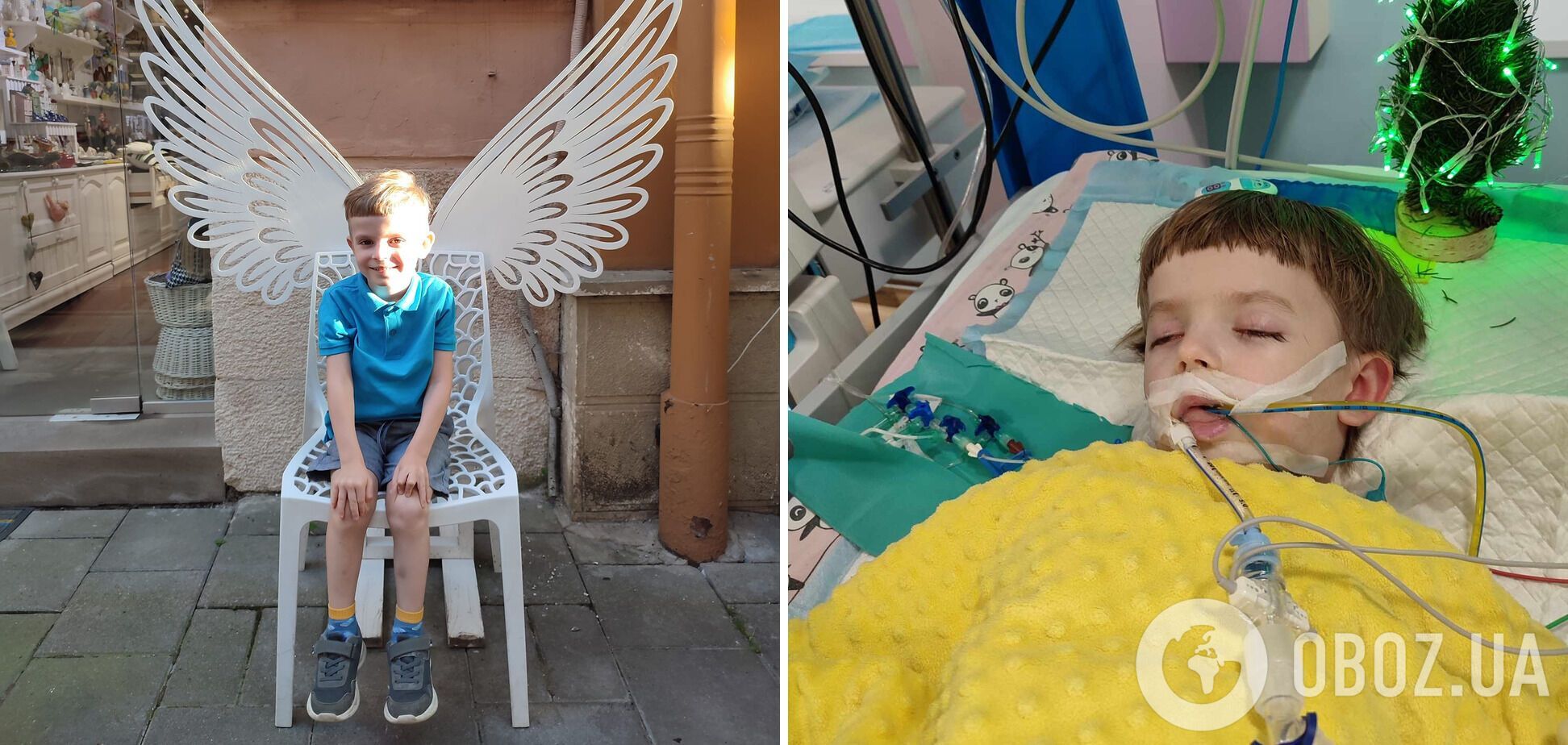 'Не имели сертификата для лечения детей': комиссия предоставила заключение о смерти 5-летнего мальчика после удаления зубов во Львове