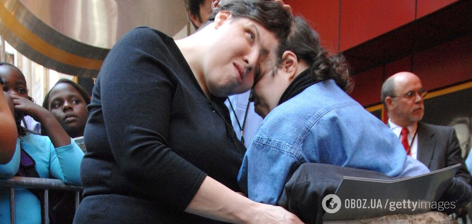 Померли найстаріші у світі сіамські близнюки: скільки років було Лорі та Джорджу Шаппеллам і який вигляд вони мали