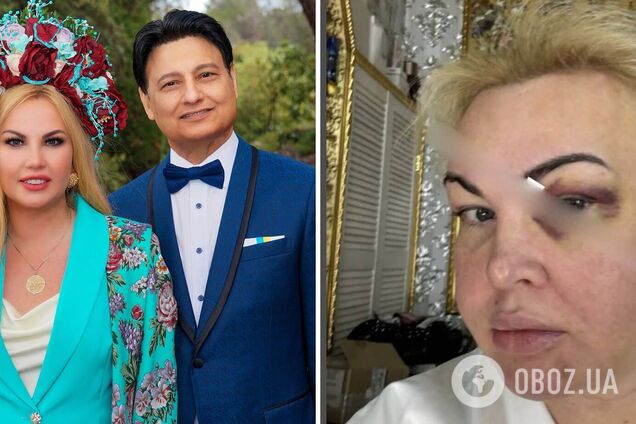 Камалія заступилася за колишнього чоловіка після резонансу із закривавленими фото та заявила, що захищатиме його