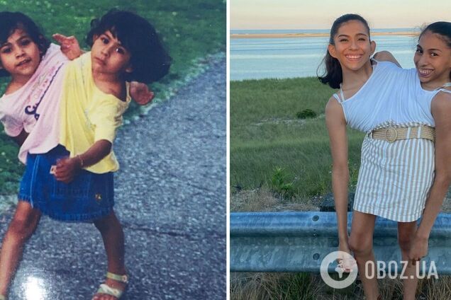 Сіамські близнючки-зірки TikTok розповіли про стосунки з чоловіками: відео Кармен і Лупіти стало вірусним