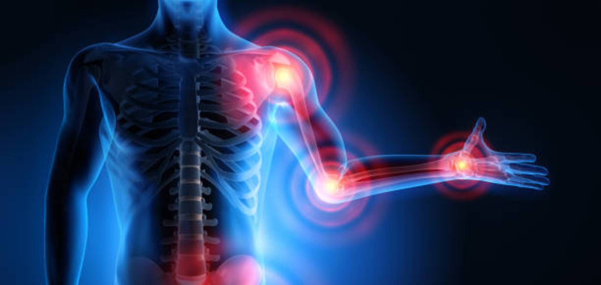 Откуда у людей взялись локти и колени: ученые 'раскопали' интересный факт