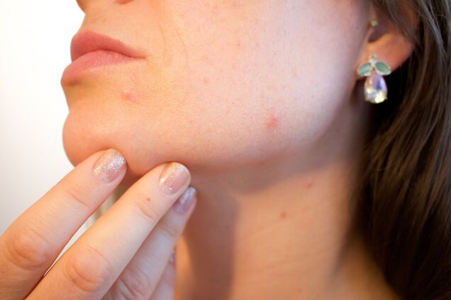 Чого боїться чутлива шкіра: 5 порад щодо догляду за ніжними руками та обличчям