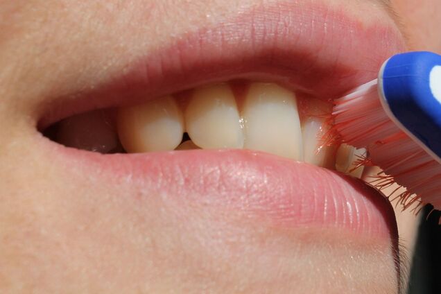 Секрети білосніжної посмішки: який догляд потрібен зубам 