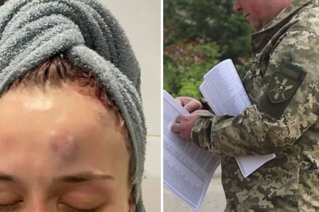 Побиття дівчини нібито співробітником ТЦК в Одесі: справу взяло на контроль Міноборони