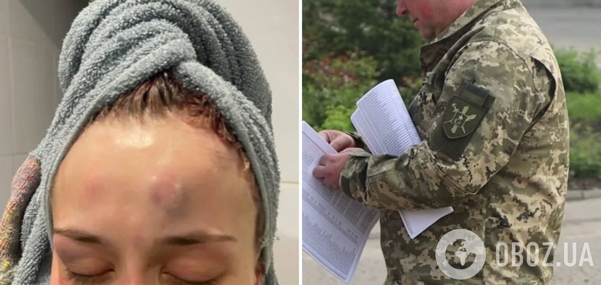 Побиття дівчини нібито співробітником ТЦК в Одесі: справу взяло на контроль Міноборони