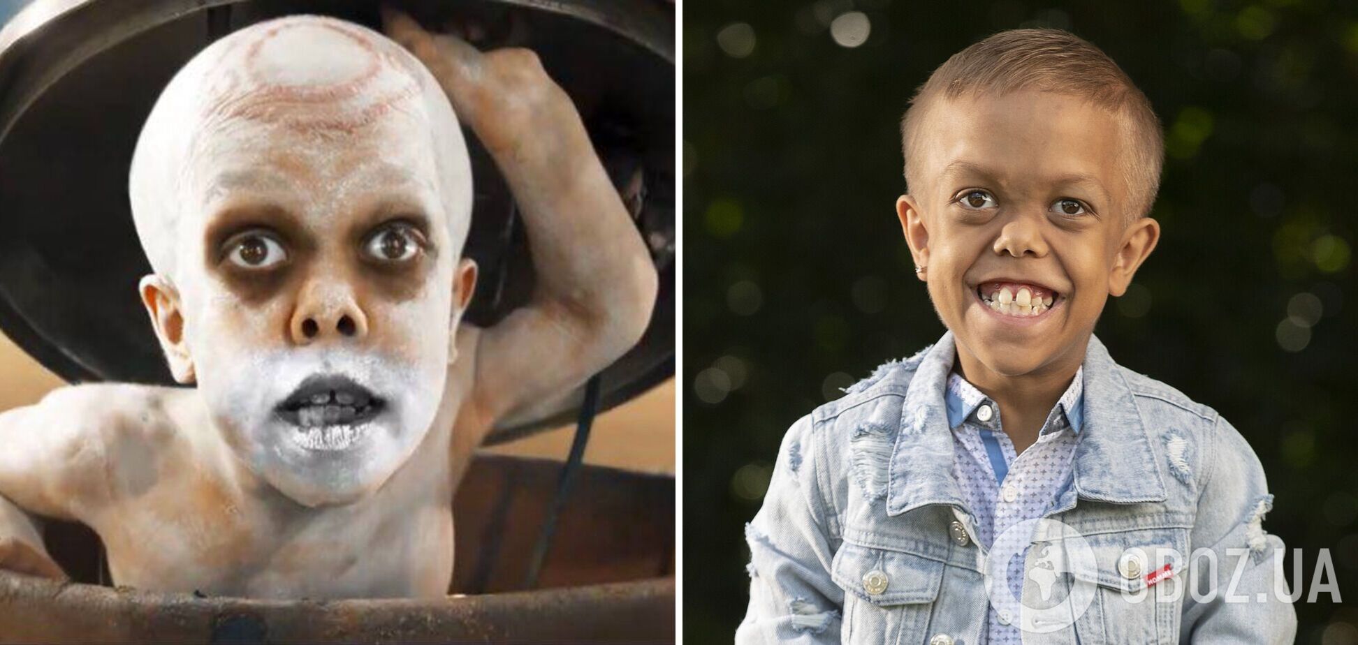 Режиссер 'Безумного Макса' сдержал слово и снял в 'Фуриосе' мальчика, которого булили из-за карликовости. Трейлер