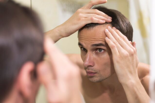 Чого не вистачає в організмі у разі сильного випадіння волосся