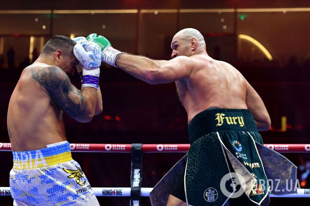 Потрапив до лікарні. Усик показав, який вигляд має його обличчя після 111 пропущених ударів у голову від Ф'юрі. Фото