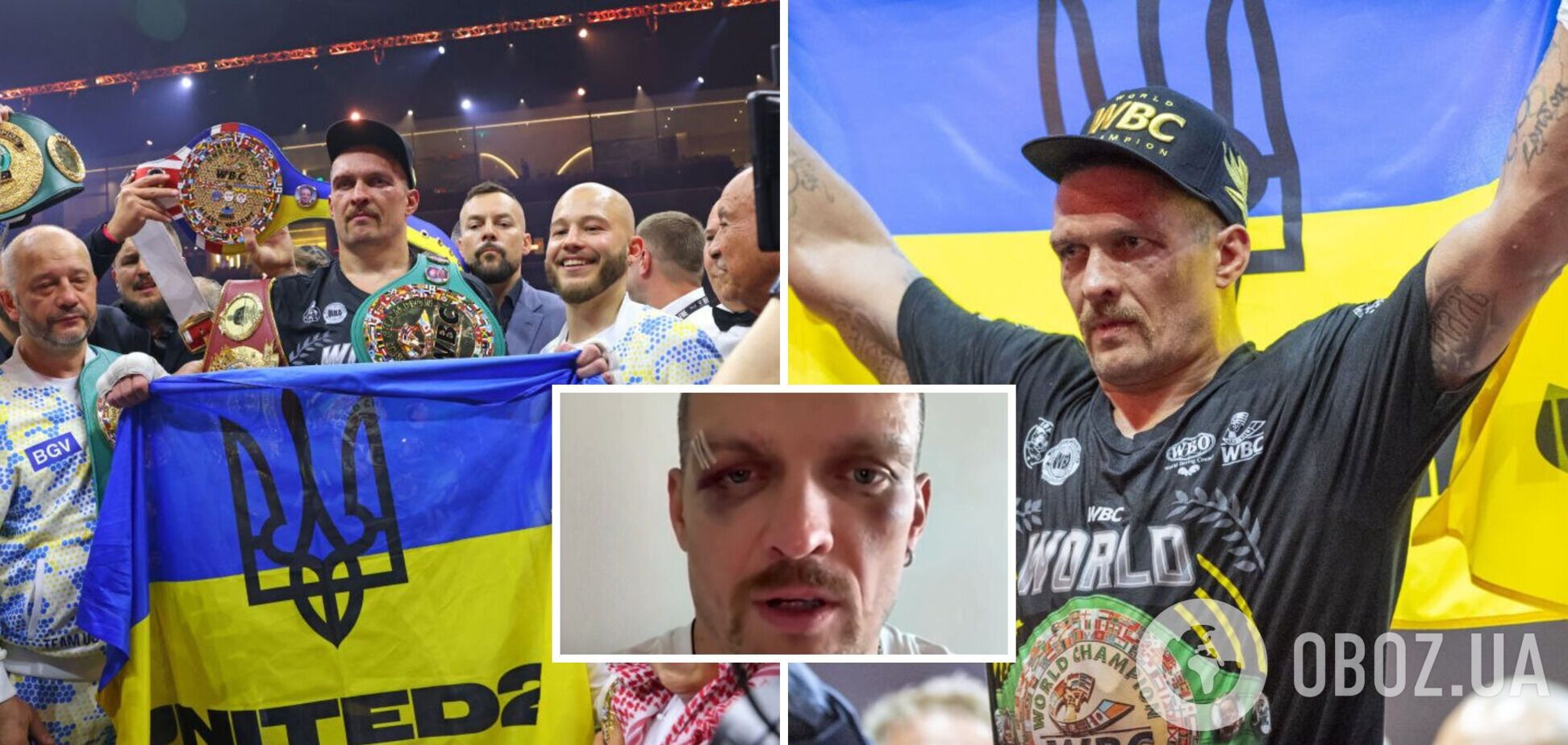 У гематомах та синцях: Усик записав звернення до українців. Відео
