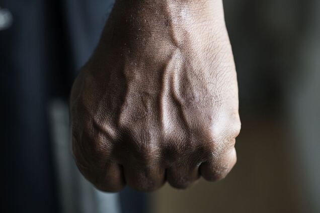 'Відшмагав різкою'. На Вінниччині директора школи звинуватили в побитті 13-річного учня: мама подала заяву в поліцію, але сільрада на боці освітянина