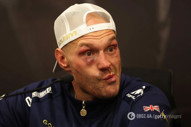 'Одна из ужаснейших вещей'. То, что сделал Фьюри после боя с Усиком, вызвало возмущение в сети