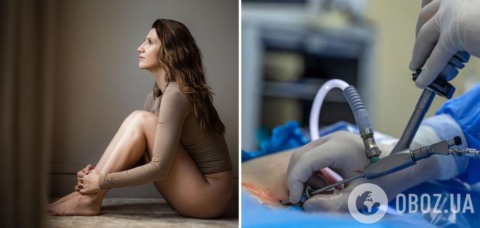 Анита Луценко впервые рассказала о встрече с хирургом, который обезобразил ее во время пластической операции