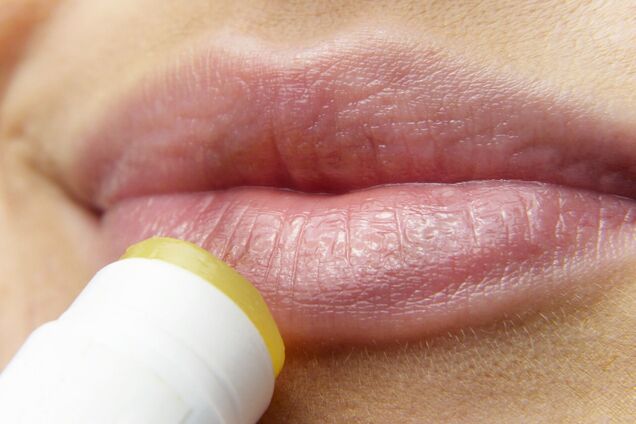 Як зробити губи м'якими: 4 способи захистити шкіру від тріщин і виразок у будь-яку пору року