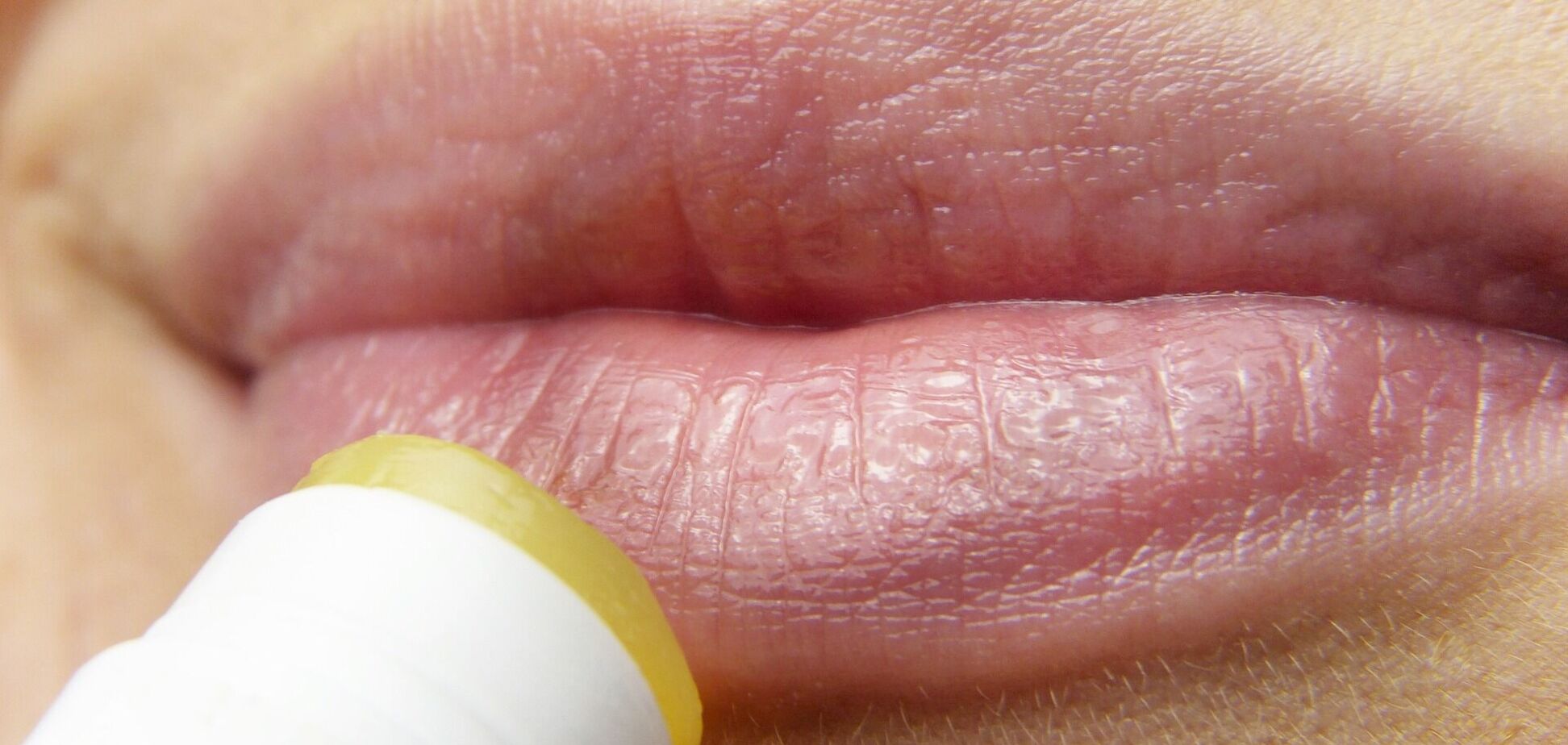 Як зробити губи м'якими: 4 способи захистити шкіру від тріщин і виразок у будь-яку пору року