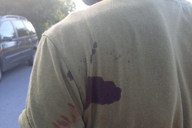 В Хмельницком мужчина ударил ножом представителя ТЦК: эмоциональное заявление военного