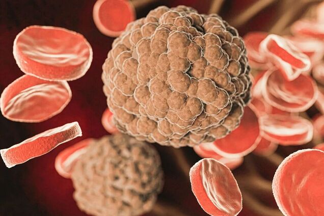 В Японии вспыхнула болезнь, убивающая человека за 48 часов: что известно