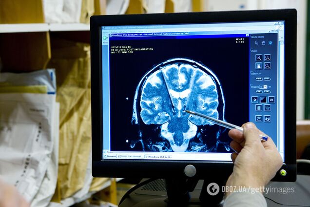 Ученые вставили 'окно' в череп человека, чтобы заглянуть в его мозг
