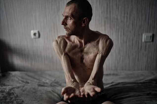 'Це була найважча наша зйомка': фотографи показали, який вигляд мають українські воїни після російського полону