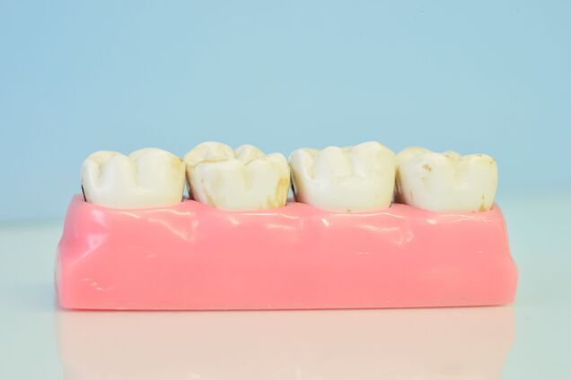 6 застережень від стоматологів, які допоможуть зберегти здоров’я зубів 

