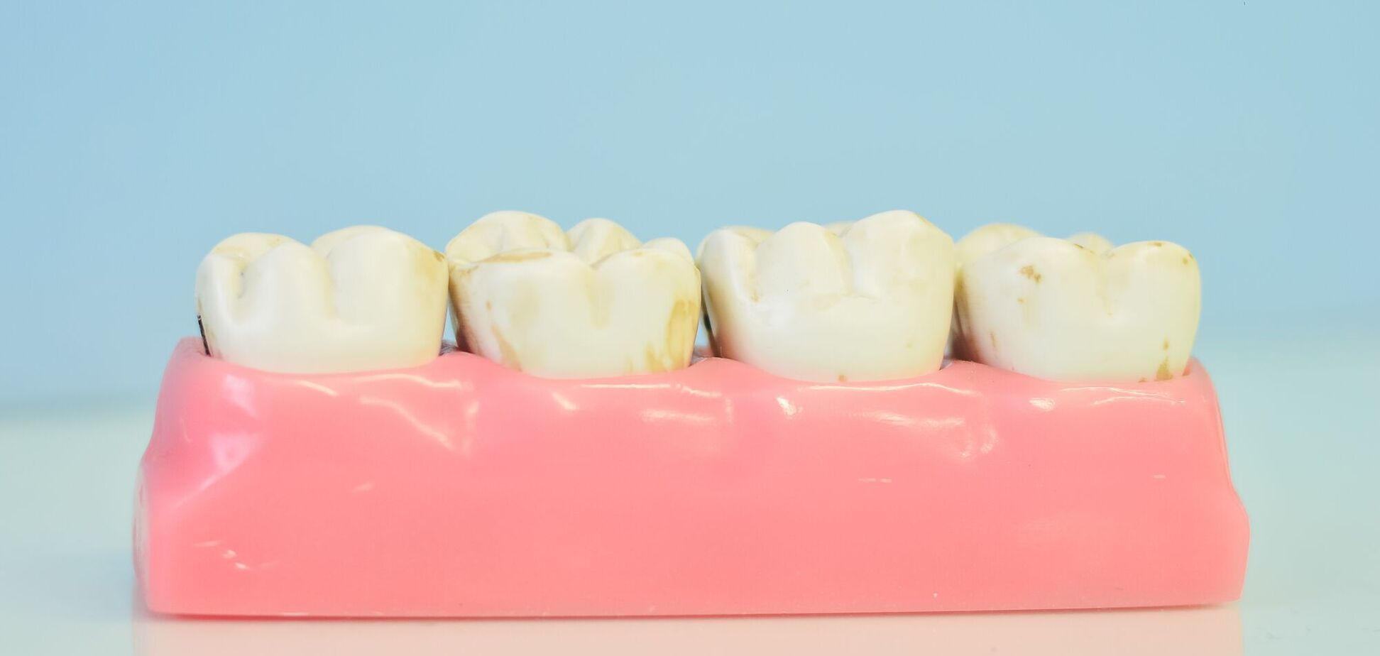 6 предостережений от стоматологов, которые помогут сохранить здоровье зубов