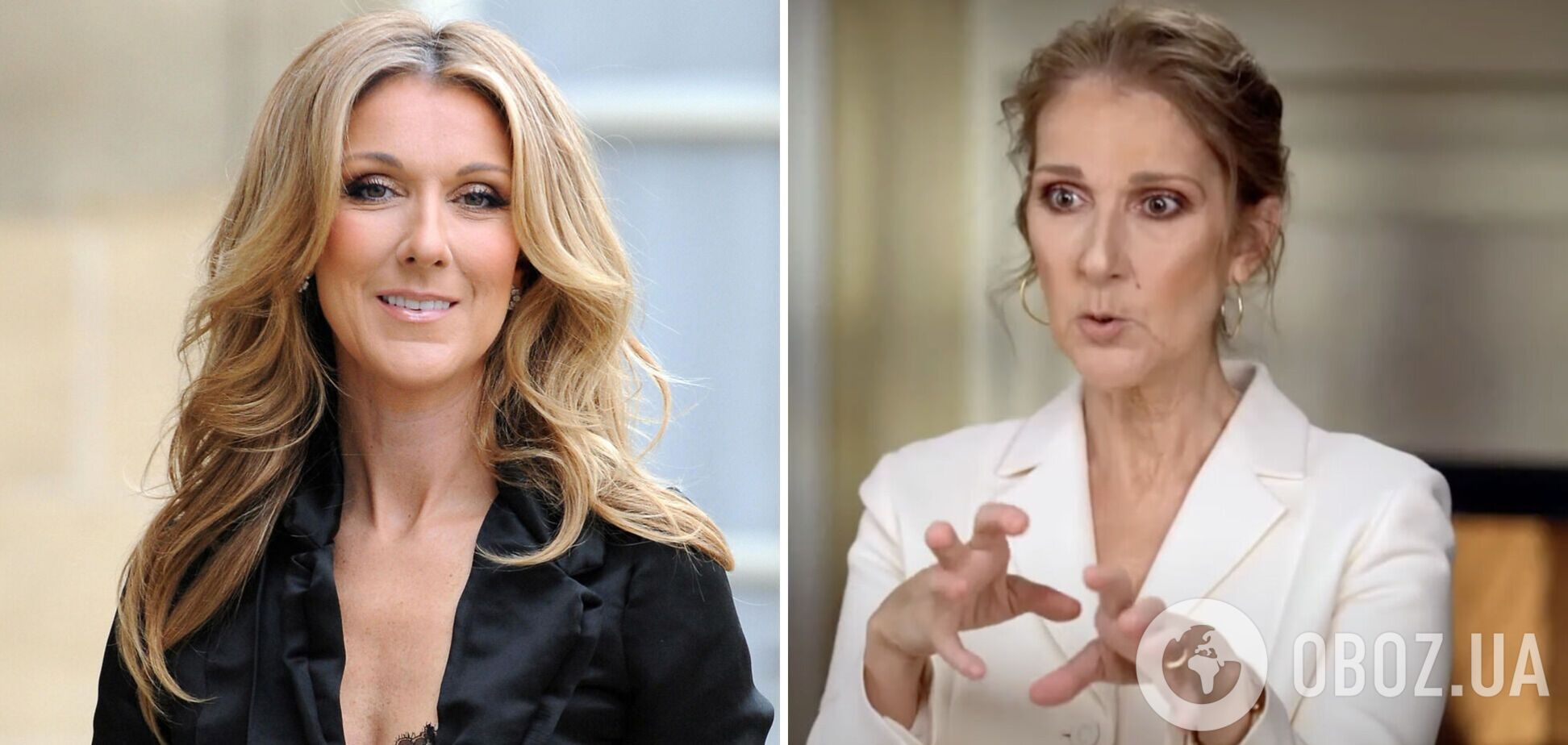 Неизлечимо больная Селин Дион изменилась до неузнаваемости: что 'синдром жесткого человека' сделал с певицей