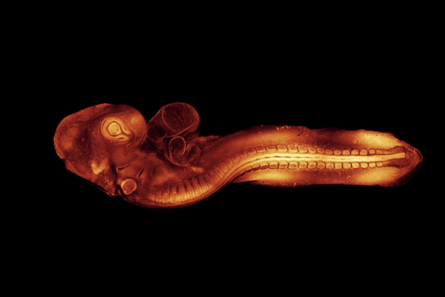 Вперше в історії. Вчені записали відео формування ембріона на ранній стадії, що допоможе виявляти вроджені вади