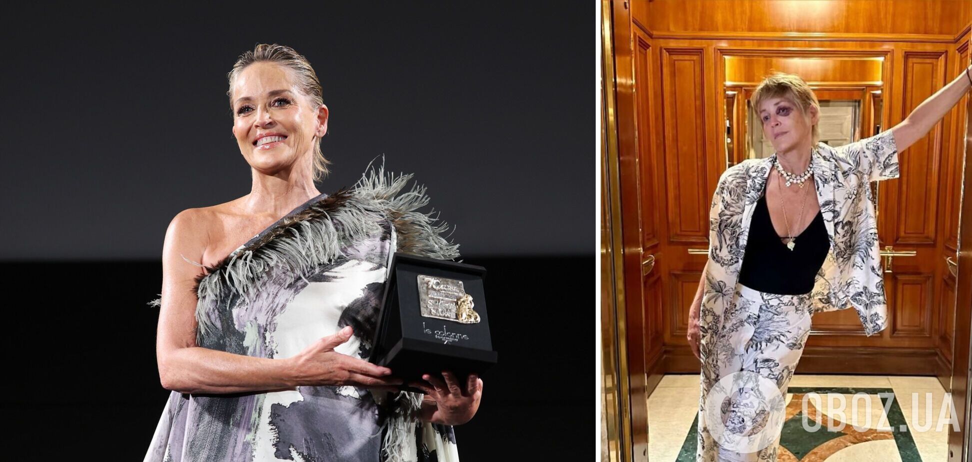 Шерон Стоун збентежила фанатів фото з величезним синцем під оком