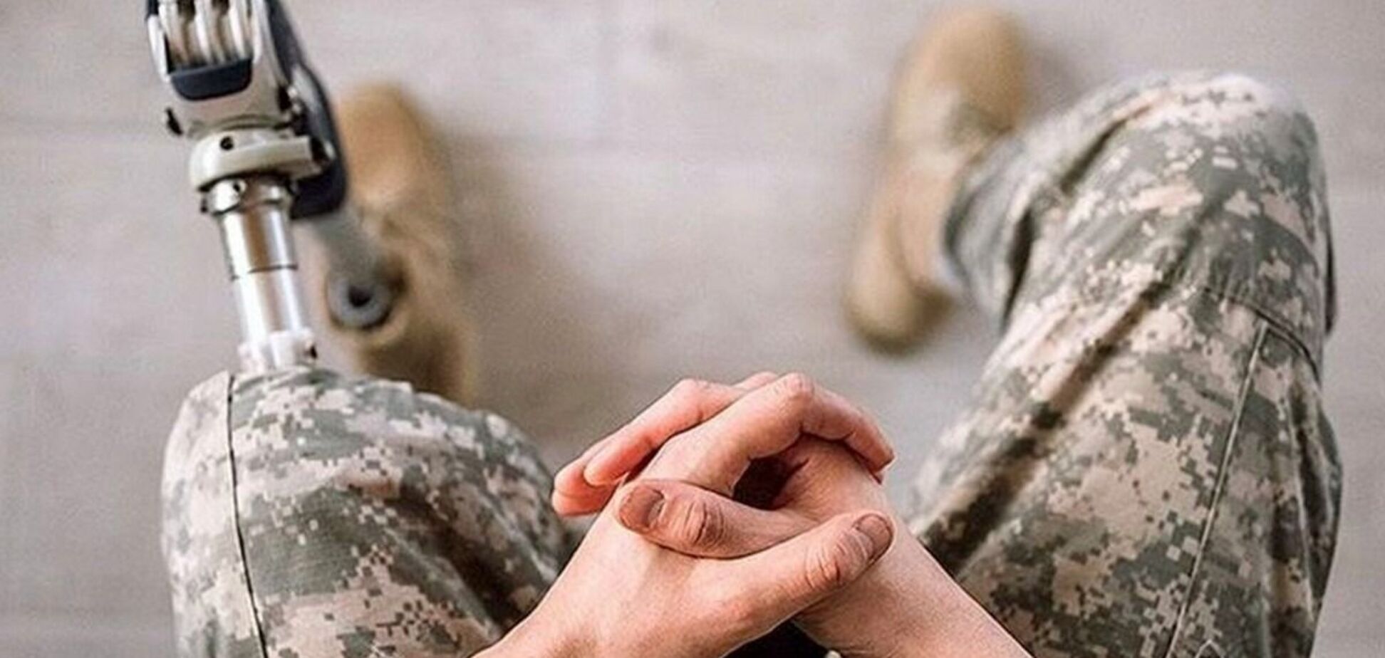 Как общаться с людьми, которые потеряли конечность: советы психолога