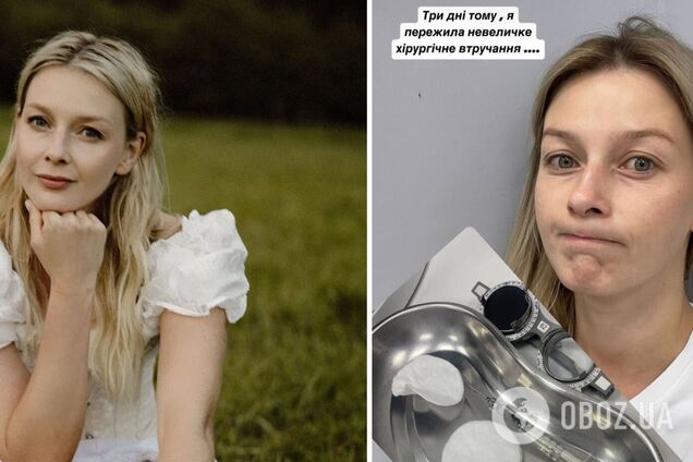 'В око встромили 10-сантиметрову голку'. Українська акторка Любава Грешнова розповіла про пережиту операцію і показала перше фото
