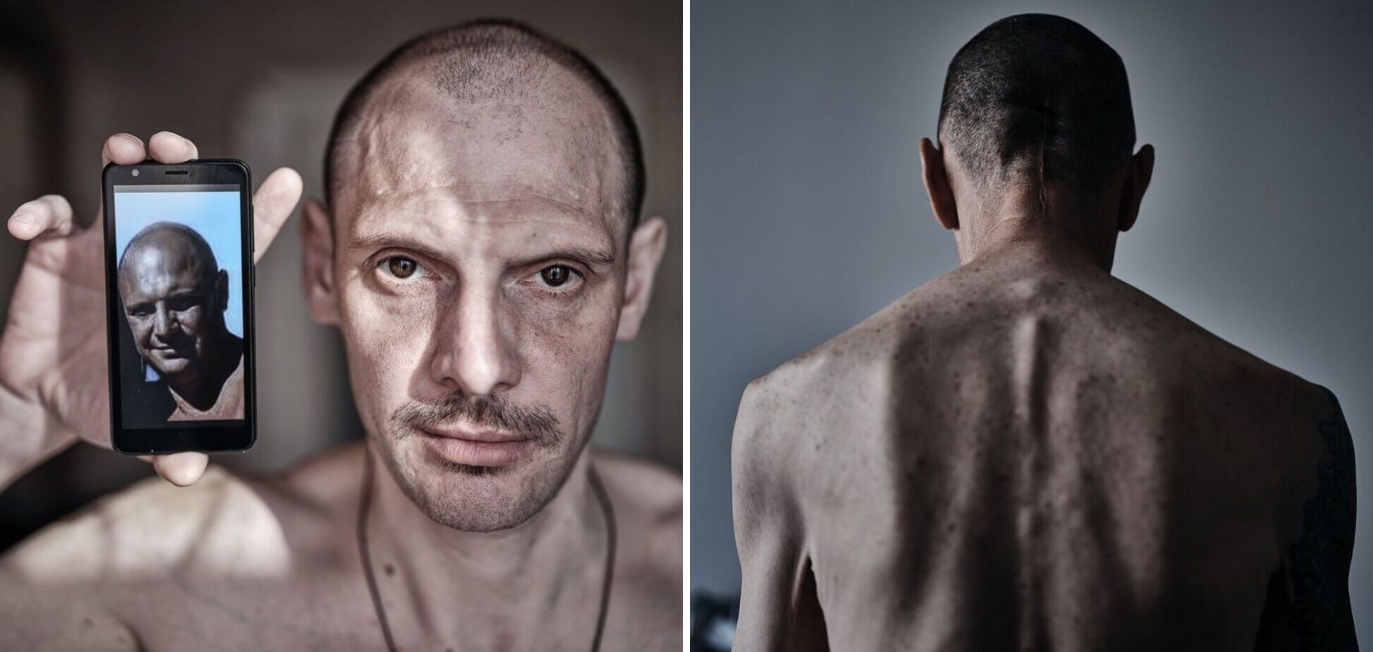 'Очі, які бачили пекло': мережу вразили фото українських військових, які повернулись з російського полону