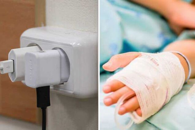 На Одещині 2-річна дівчинка отримала опіки через вибух зарядного пристрою