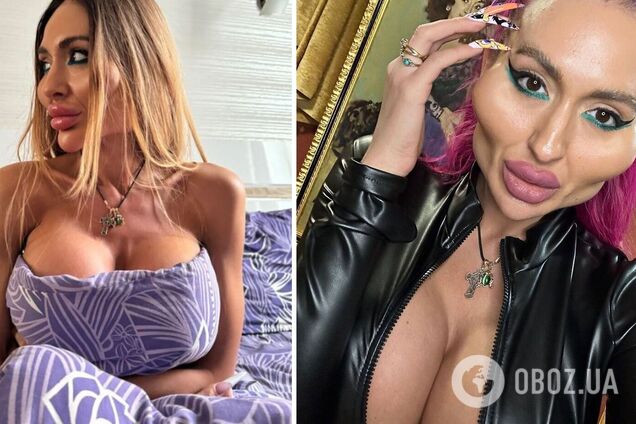 'Хотела больший размер'. Украинская королева пластики рассказала о трех операциях на груди и 6-часовом хирургическом вмешательстве