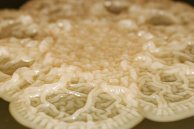 Представьте большое густое дерево. Ученые объяснили, как бактерии размножаются во рту