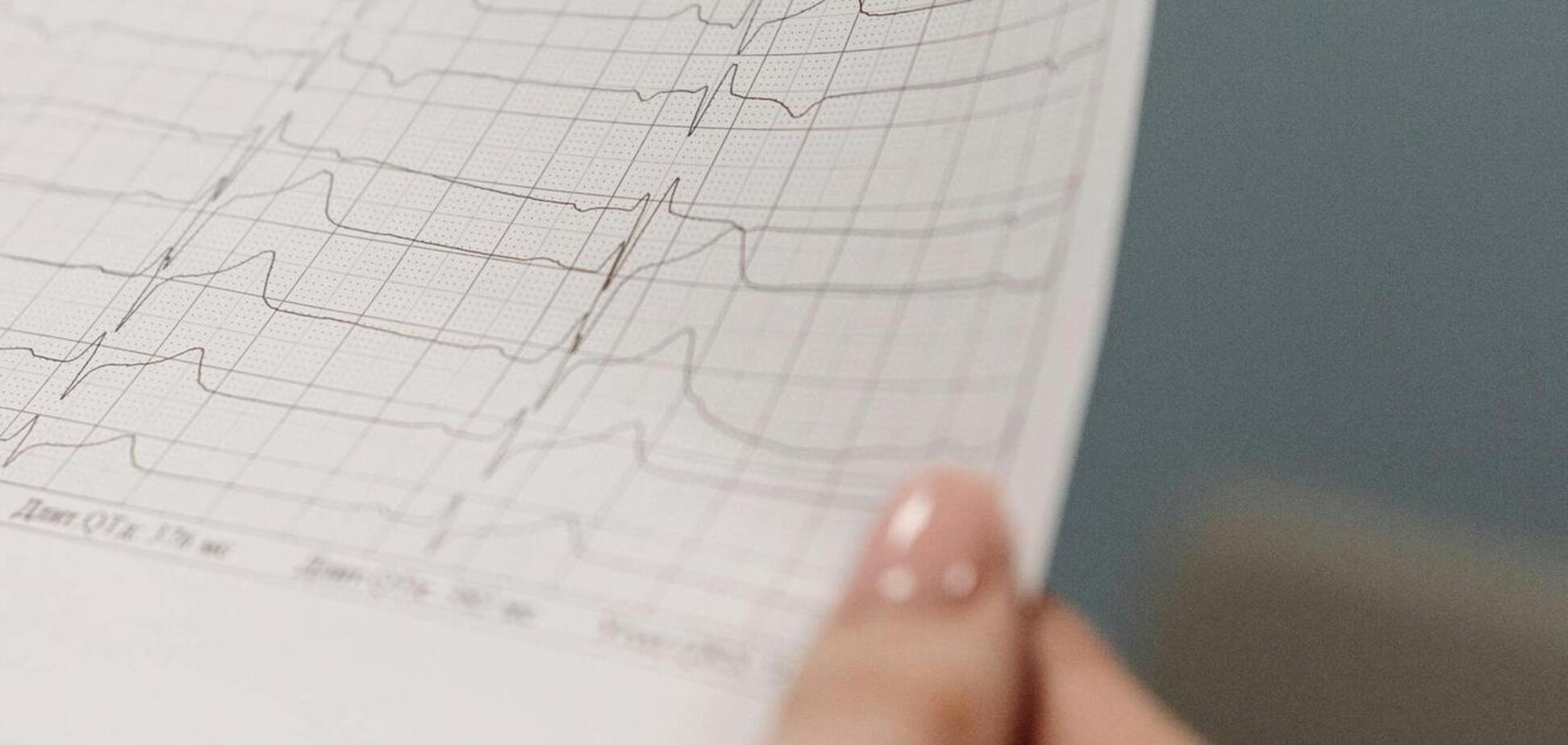 Почему нельзя говорить 'кардиограмма сердца': в чем ошибка